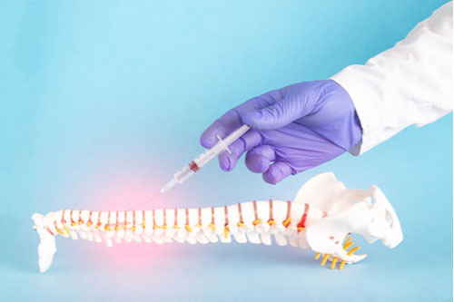 Concept of injections for back pain in Greenville SC