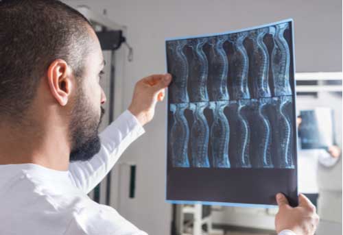 Doctor viewing spine x-ray spine pain treatment in Greenville SC concept